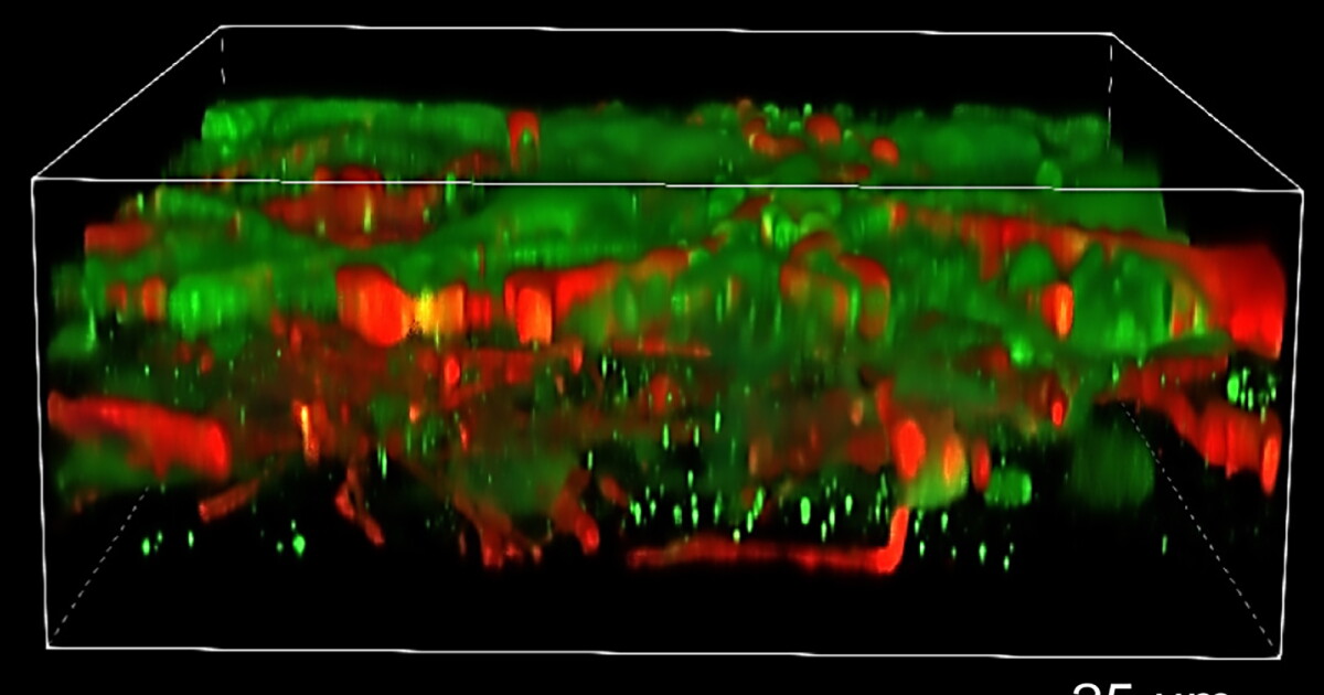 First 3D-printed functional human brain tissue grows like the real thing